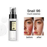 100ML Snail Mucin Serum,Advanced Snail 96 Mucin Power Essence,Snail Mucin Repair Dark Spots