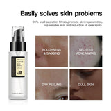 100ML Snail Mucin Serum,Advanced Snail 96 Mucin Power Essence,Snail Mucin Repair Dark Spots