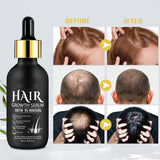 5% Minoxidil for Men and Women Hair Growth Serum for Stronger Hair Growth, Stop Hair Loss (60ML)